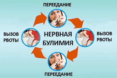Лечение булимии в Ейске